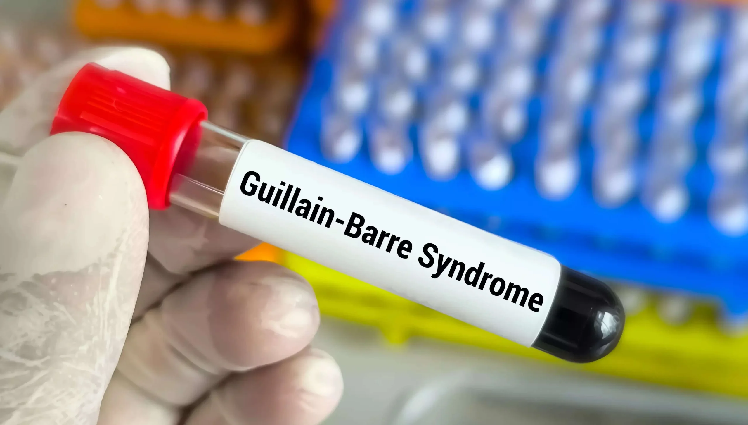 Guillain-Barré Syndrome Outbreak: Maharashtra and West Bengal Report Rising Cases